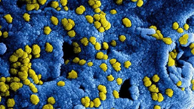 一线｜美国研究机构：已开始新型冠状病毒疫苗研发 最快3个月后人体试验